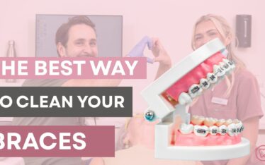 How To Best Clean Your Braces Banner 374x234